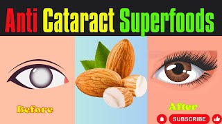 Prevent Cataract surgeryTop 7 superfoods to slow down cataract Top 5 eye exercises [upl. by Ferneau403]