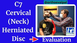 C7 Cervical neck Herniated Disc Evaluation [upl. by Reywas]