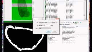 Cortical bone 1 periosteal and endosteal parameters [upl. by Reinold]