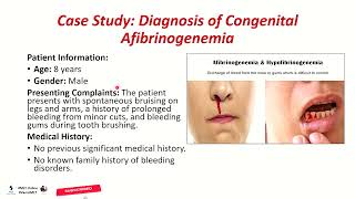 MLT Case Study Afibrinogenemia 🩸🧬🧑‍⚕️ chandigarhuniversity Study By Attuluri Vamsi Kumar [upl. by Cykana]