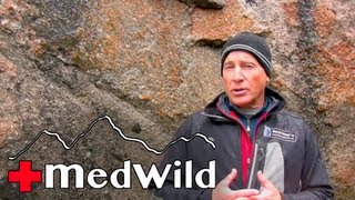 Wilderness Medicine Altitude Illness  HAPE Treatment [upl. by Witherspoon126]