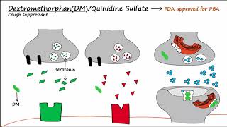 Pseudobulbar Affect PBA  Part 2  Treatment [upl. by Anidan]