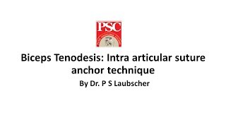 Biceps Tenodesis Intra articular suture anchor technique By Dr P S Laubscher [upl. by Ennaeirb]