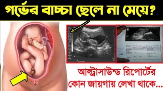 আল্ট্রাসাউন্ড রিপোর্ট দেখে কিভাবে বুঝবেন গর্ভের বাচ্চা ছেলে না মেয়ে  আল্ট্রাসনোগ্রাফি রিপোর্ট [upl. by Analat813]