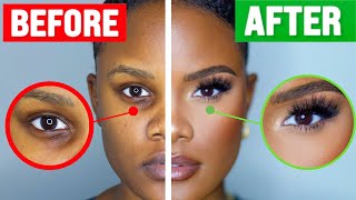 How To COVER Dark Under Eye Circles [upl. by Ahtanaram593]