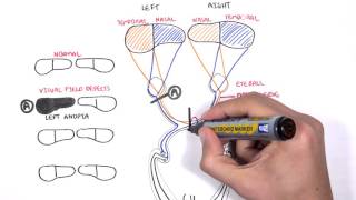 Visual Pathway and Lesions [upl. by Shutz]