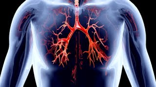 How to Remove Calcium Deposits From Arteries  Clogged Arteries Home Remedies [upl. by Nilla]