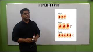 Hypertrophy in hindi [upl. by Irmo354]