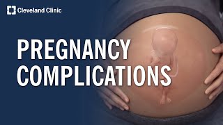 Common Pregnancy Complications Explained [upl. by Semadar527]