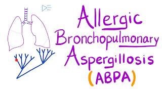 Allergic Bronchopulmonary Aspergillosis ABPA  Asthma Cough Eosinophils  Lungs [upl. by Yonatan530]