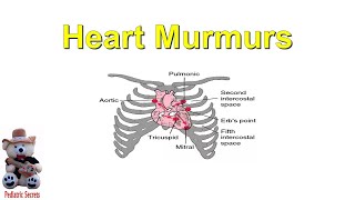 Systolic murmur in mitral regurgitation [upl. by April5]