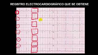 CURSO DE ELECTROCARDIOGRAFIA 08  REGISTRO ELECTROCARDIOGRÁFICO QUE SE OBTIENE [upl. by Saltsman]