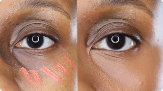 FULLY COVER DARK CIRCLES using Orange color corrector [upl. by Nwahsek778]