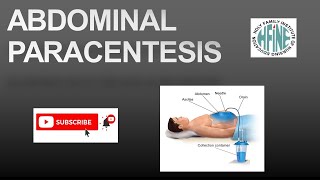 ABDOMINAL PARACENTESIS NURSING PROCEDURE [upl. by Yevrah]