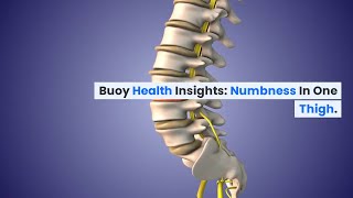 Numbness in One Thigh Common Causes and When to Seek Medical Care  BuoyHealthcom [upl. by Sobel]