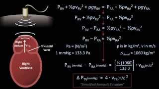 The Bernoulli Equation  Medical Applications Fluid Mechanics  Lesson 8 [upl. by Dewhurst81]