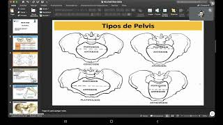 CLASE 8  OBSTETRICIA  PELVIMETRIA [upl. by Gnuh]