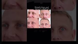 كيف يدوم البوتوكس بالزنك shortscraft اكسبلور بوتكس بوتكسالشعر فيلرالوجه تجميل تجميليه ه [upl. by Edualc]