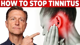 How to Stop Tinnitus ringing in the ears – Try DrBergs Home Remedy to Get Rid of It [upl. by Suivatco]