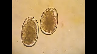 Hookworms in dogs  Ancylostoma caninum Flotation method [upl. by Niarda]