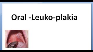 Pathology 523 a Oral Leukoplakia white plaque patch hyperkeratotic dysplastic hairy type [upl. by Eelarat176]