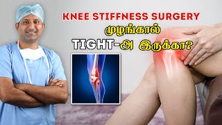 Stiff Knee surgery  முழங்கால் முழுவதும் மடங்க அறுவை சிகிச்சை  Dr Jeya Venkatesh [upl. by Acireed19]