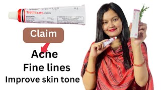 I tried Tretinoin Cream 005  most demanding cream  honest review by Kiransrana [upl. by Ayatnwahs]