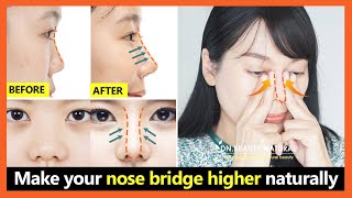 5 Best steps How to lift your nose bridge higher get perfect nose without surgery [upl. by Aliehs]