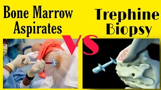 Bone Marrow Aspiration and Trephine Biopsy Technique Urdu amp Hindi [upl. by Barfuss]