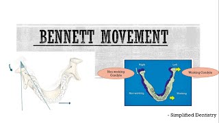 Bennett movement [upl. by Zorine]