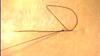 55 Subcuticular Suture The Invisible Suture Basic Surgery Skills [upl. by Llertniuq529]