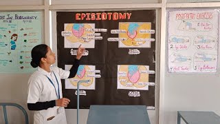 explanation about episiotomy procedure🧑‍⚕️ shortvideo exploremore exploremore episiotomy nurse [upl. by Aikkan]