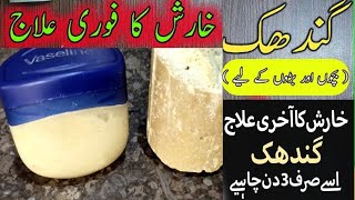 Gandhak se Kharish \ Scabies Ka Ilaj  Just Add 1 Ingredient amp See Result in 3 Days 100 guaranteed [upl. by Frida417]