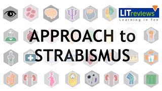 Approach to Strabismus [upl. by Buke576]