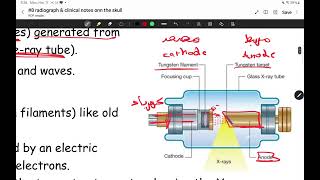 head amp neck anatomy II lecture 8 radiography and clinical notes on skull II majed rumman [upl. by Shore]