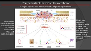 FIBROSIS OF THE RETINA AFTER INTRAVITREAL INJECTIONS [upl. by Erminie]