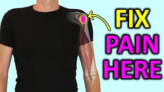 Front Shoulder Pain Fix the REAL cause of Biceps Tendonitis [upl. by Lap]