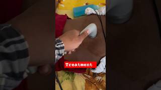 LOW BACK PAIN TREATMENT shortsfeed shortvideos [upl. by Tolmach328]