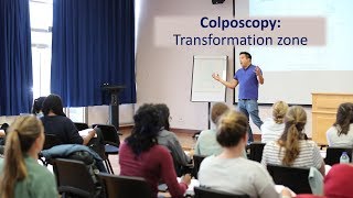 Colposcopy Transformation Zone for the MRCOG by Dr Justin Chu [upl. by Lilias249]