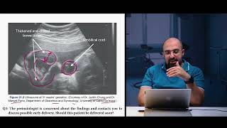 Ep 94 Gastroschisis8 case study CS amp premature deliveryDr Khaled Salah gastroschisis premature [upl. by Biel719]