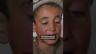 Mines unexploded ordnance a daily menace for Afghanistans children  AFP shorts [upl. by Dudden]