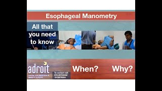 Esophageal Manometry Know when and why it is needed  Ahmedabad Gujarat INDIA [upl. by Sturrock]