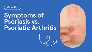 Psoriasis vs Psoriatic Arthritis Symptoms  GoodRx [upl. by Atoiyanap]