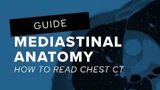 How to read chest CT mediastinal anatomy [upl. by Denney]