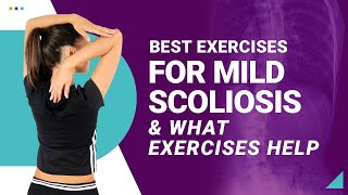 Best Exercises for Mild Scoliosis amp What Exercises Help [upl. by Ecnesse]