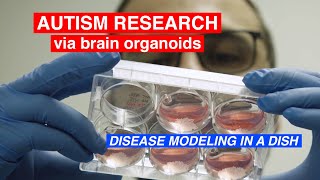 Stem Cells and Disease Modeling in a Dish Autism Research via Brain Organoids [upl. by Ettedualc690]