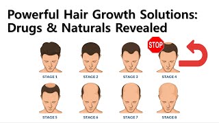 Powerful Hair Growth Solutions Drugs amp Naturals Revealed [upl. by Dalli]