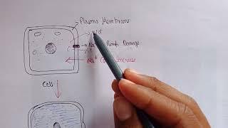 hydropic change in cell  hydropic change pathophysiology  cell swelling [upl. by Aggappera996]