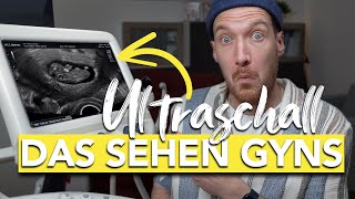 Was ist das Ultraschall in der Schwangerschaft enträtselt I vom Embryo bis zum Baby [upl. by Netsoj403]