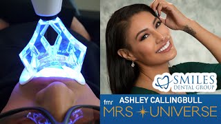 Express Teeth Whitening  Part 5  Ashley Callingbulls Smile Journey [upl. by Adnouqal]